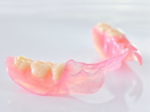 ノンクラスプデンチャー